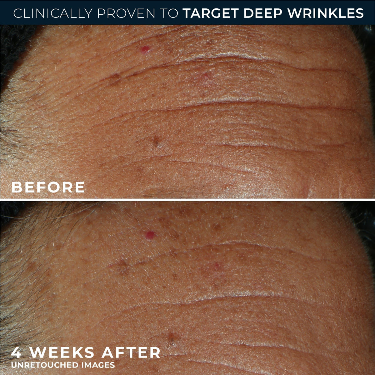 RoC Derm Correxion Fill + Retinol Serum lifestyle scene