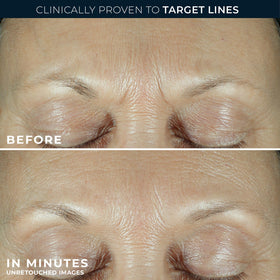 RoC Derm Correxion Fill + Retinol Serum with ingredients list