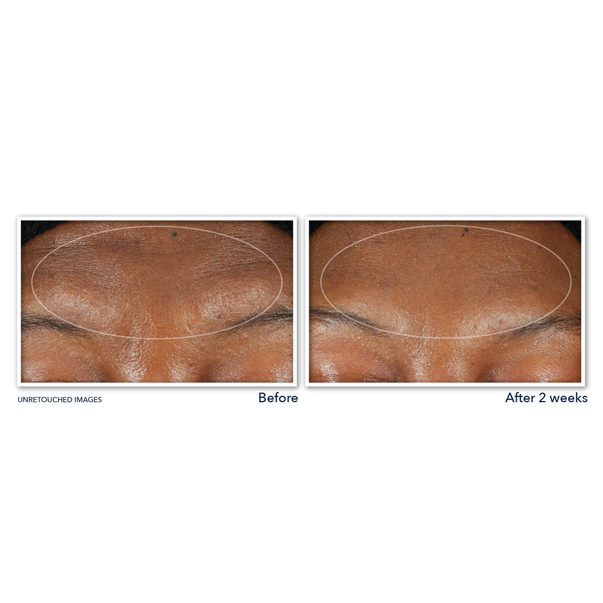 RoC Derm Correxion Serum Cleanser application on skin