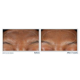 RoC Derm Correxion Serum Cleanser application on skin