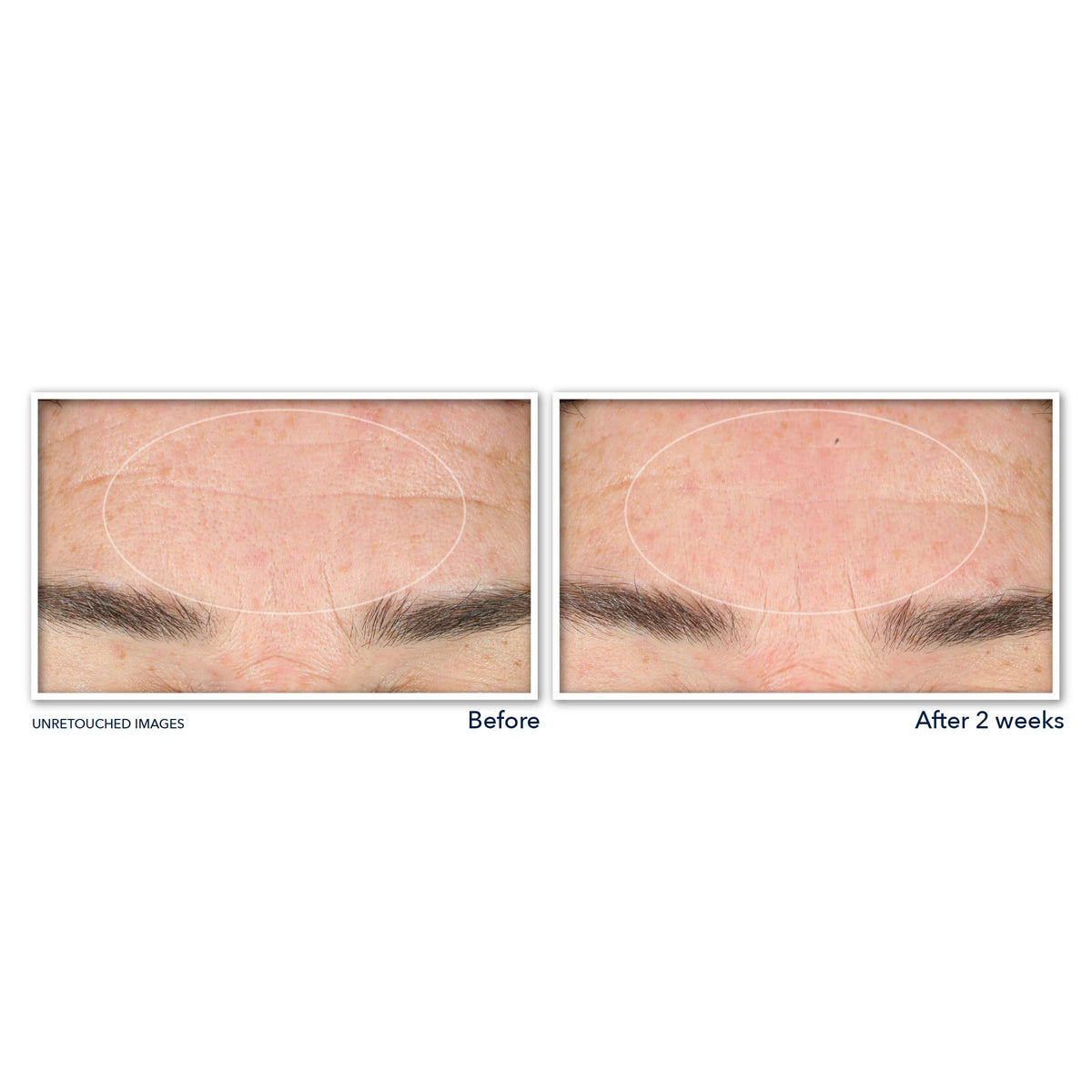RoC Derm Correxion Serum Cleanser texture close-up