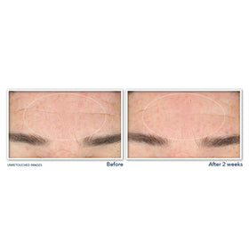 RoC Derm Correxion Serum Cleanser texture close-up