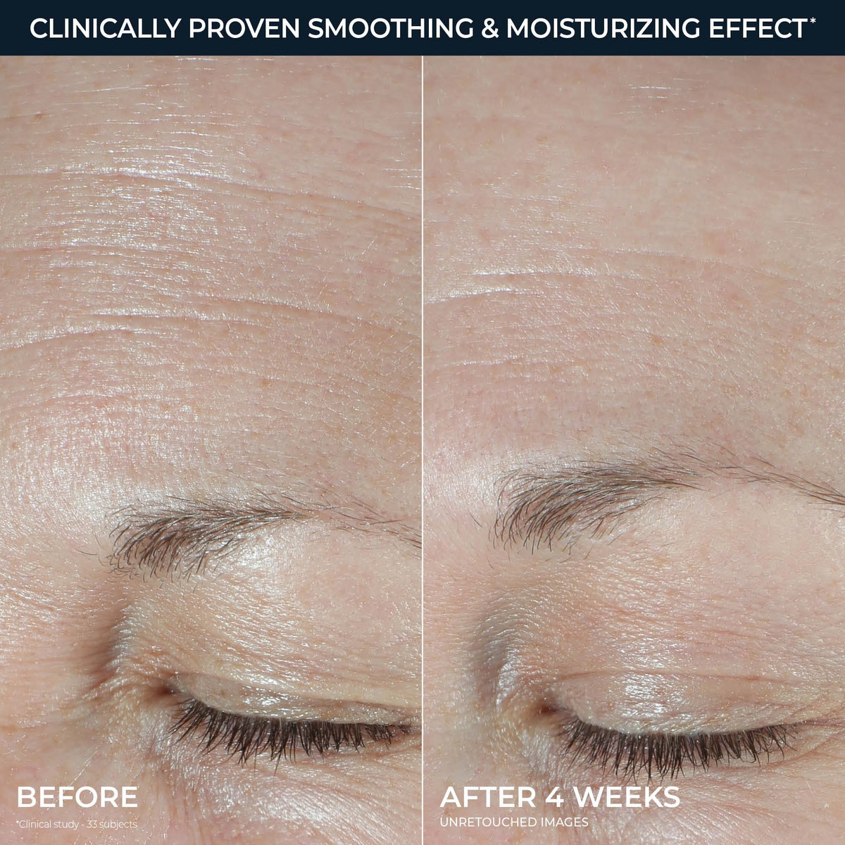 RoC Hydration+ Moisturizer applied on hand