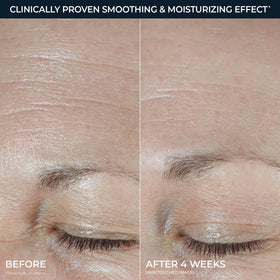 RoC Hydration+ Moisturizer applied on hand