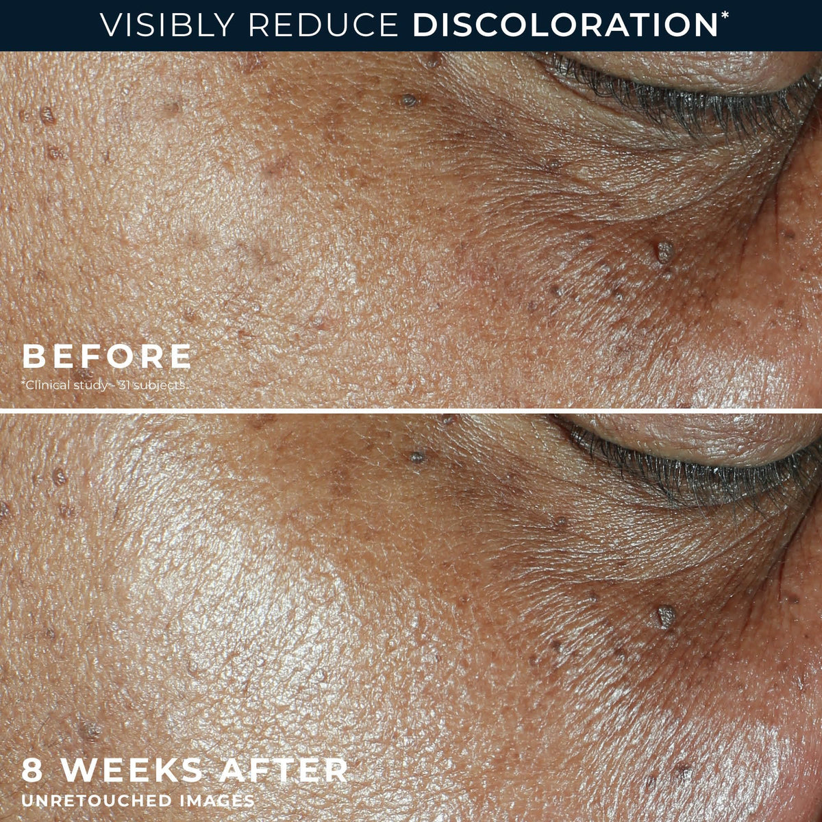 RoC Niacinamide Daily Face Moisturizer SPF 30 lifestyle use