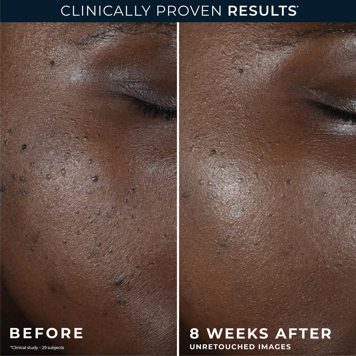 RoC Niacinamide Night Cream ingredients list