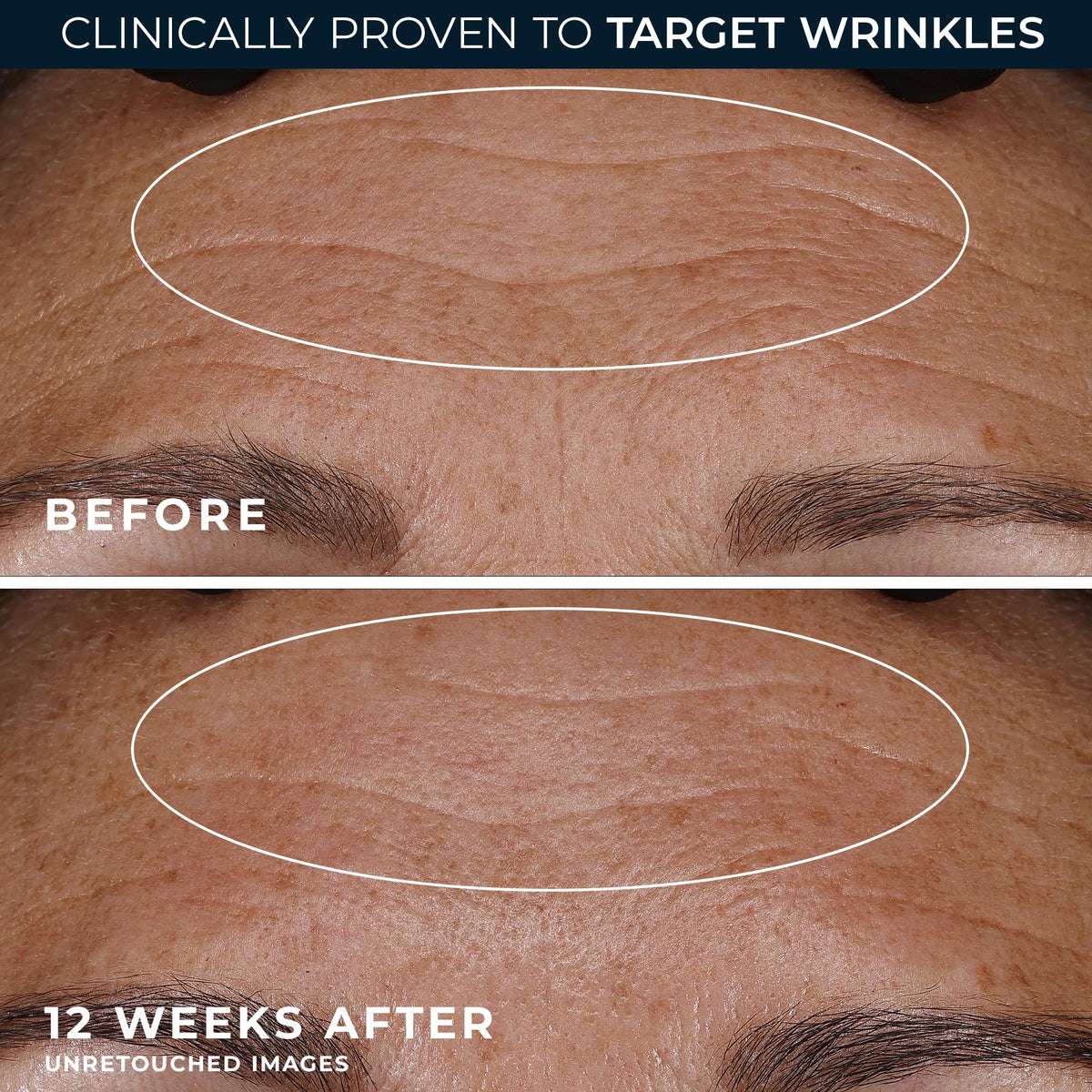 RoC Retinol Correxion Deep Wrinkle Night Cream ingredients list