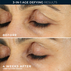 RoC Retinol Correxion Eye Cream Mini in a beauty routine
