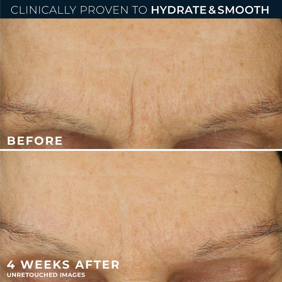 RoC Retinol Correxion Max Daily Hydration Face Moisturizer application on skin