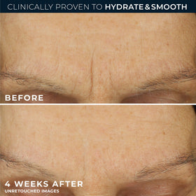RoC Retinol Correxion Max Daily Hydration Face Moisturizer application on skin
