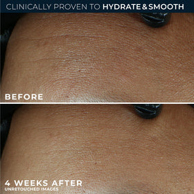 RoC Retinol Correxion Max Daily Hydration Face Moisturizer texture on hand