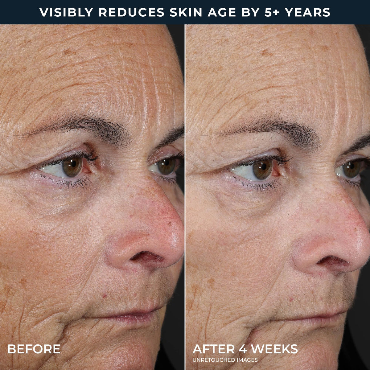 RoC Retinol Correxion Peel Pads in use on skin
