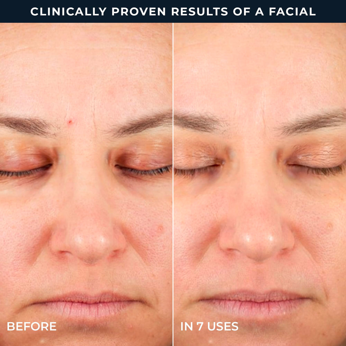 RoC Retinol Correxion Peel Pads ingredients list