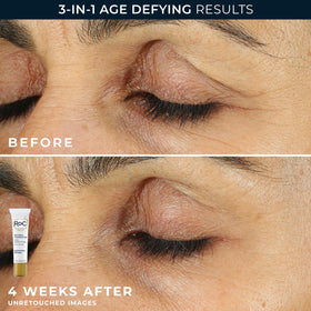 RoC Retinol Correxion Value Set on a bathroom shelf