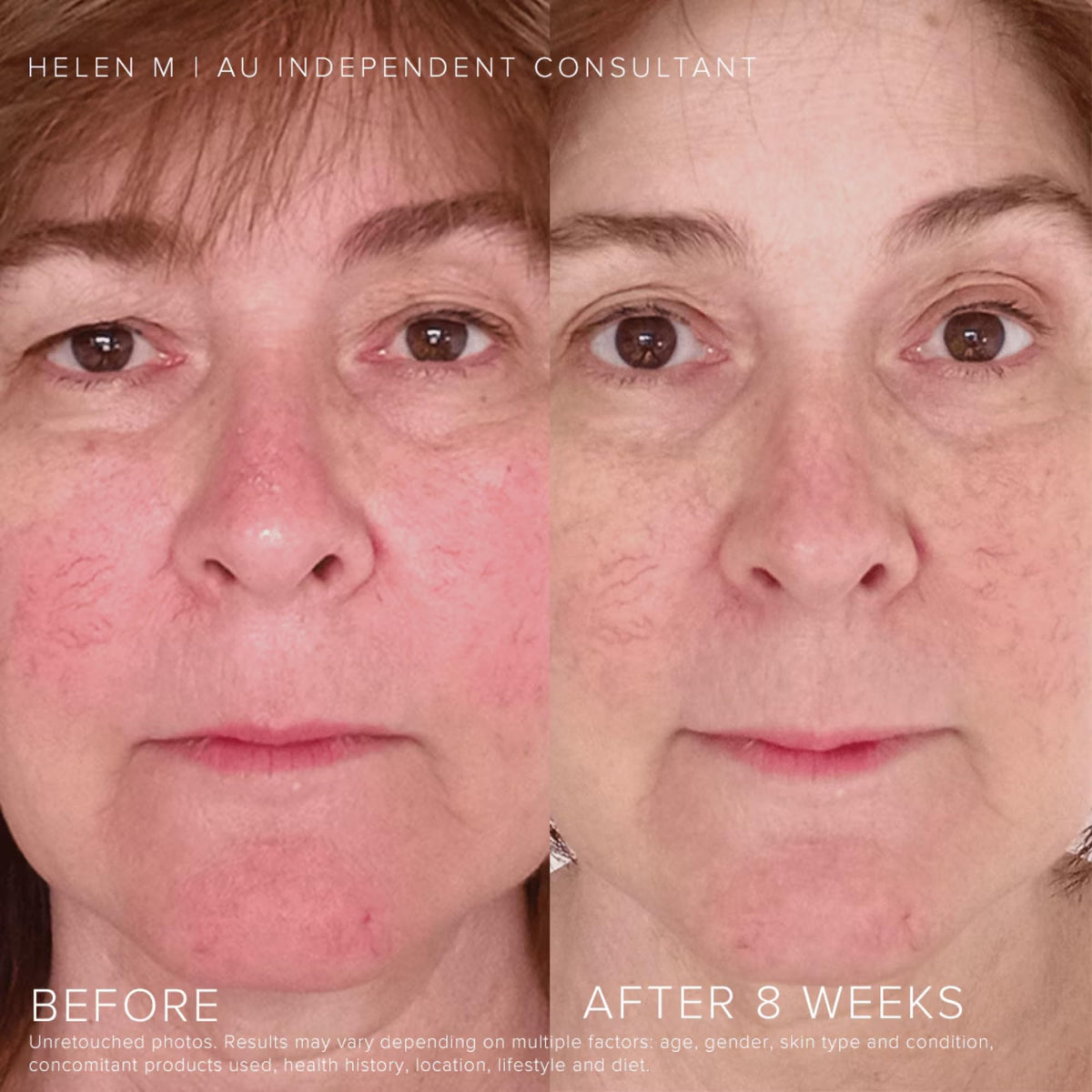 RODAN + FIELDS Soothe Regimen calming cream side view