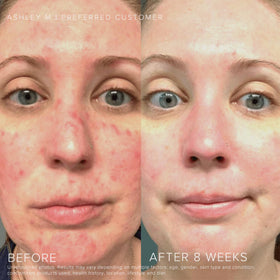 RODAN + FIELDS Soothe Regimen hydrating moisturiser close-up