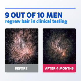 Rogaine Men's 5% Minoxidil Foam foam texture close-up