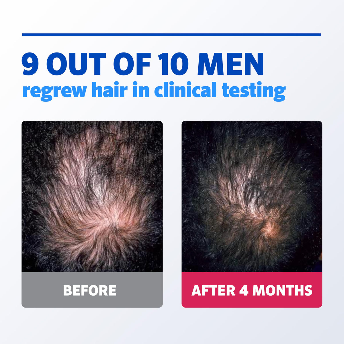 Rogaine Men's 5% Minoxidil Foam packaging details