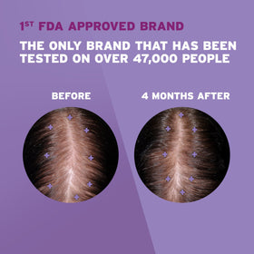 Rogaine Women's 2% Minoxidil bottle side view