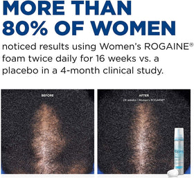 Rogaine Women's 5% Minoxidil Foam packaging details