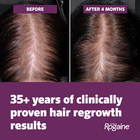 Rogaine Women's Hair Growth Foam 5% Minoxidil application process