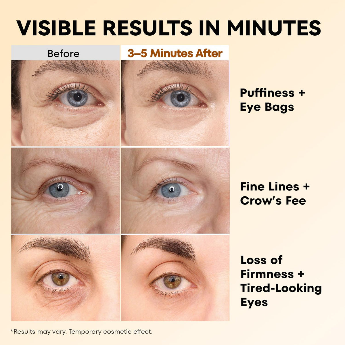 RONKIE Instant Firm Eye Tightener application on skin