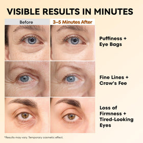 RONKIE Instant Firm Eye Tightener application on skin