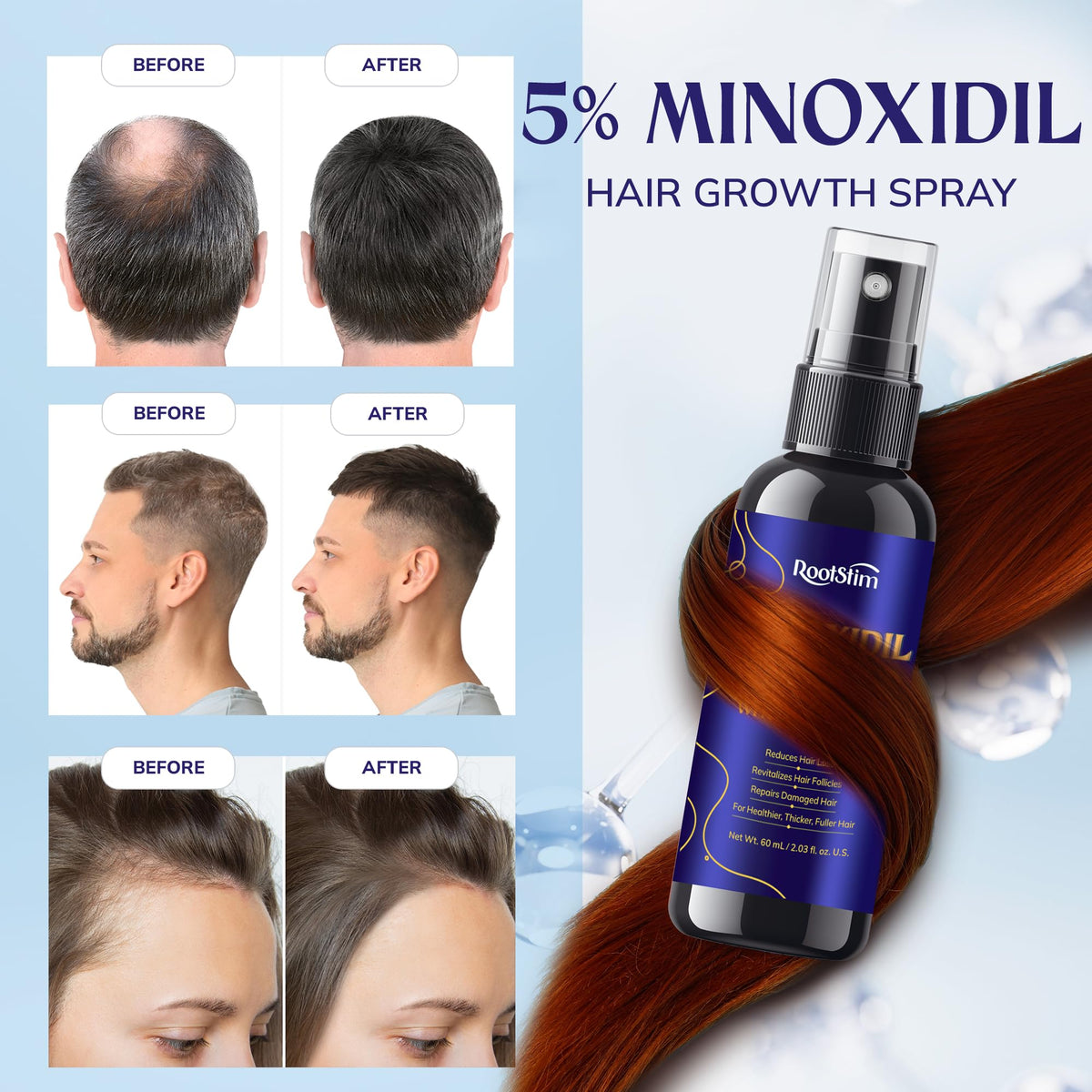 RootStim 5% Minoxidil Hair Growth close-up of bottle