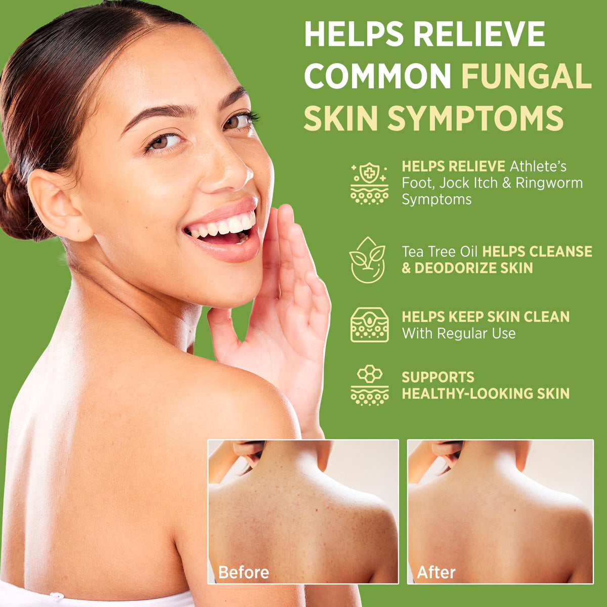 Roycederm Antifungal Bar Soap packaging with ingredients listed