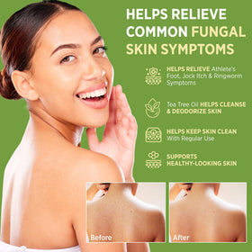 Roycederm Antifungal Bar Soap packaging with ingredients listed