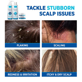 Roycederm Scalp Therapy System set displayed on a bathroom shelf