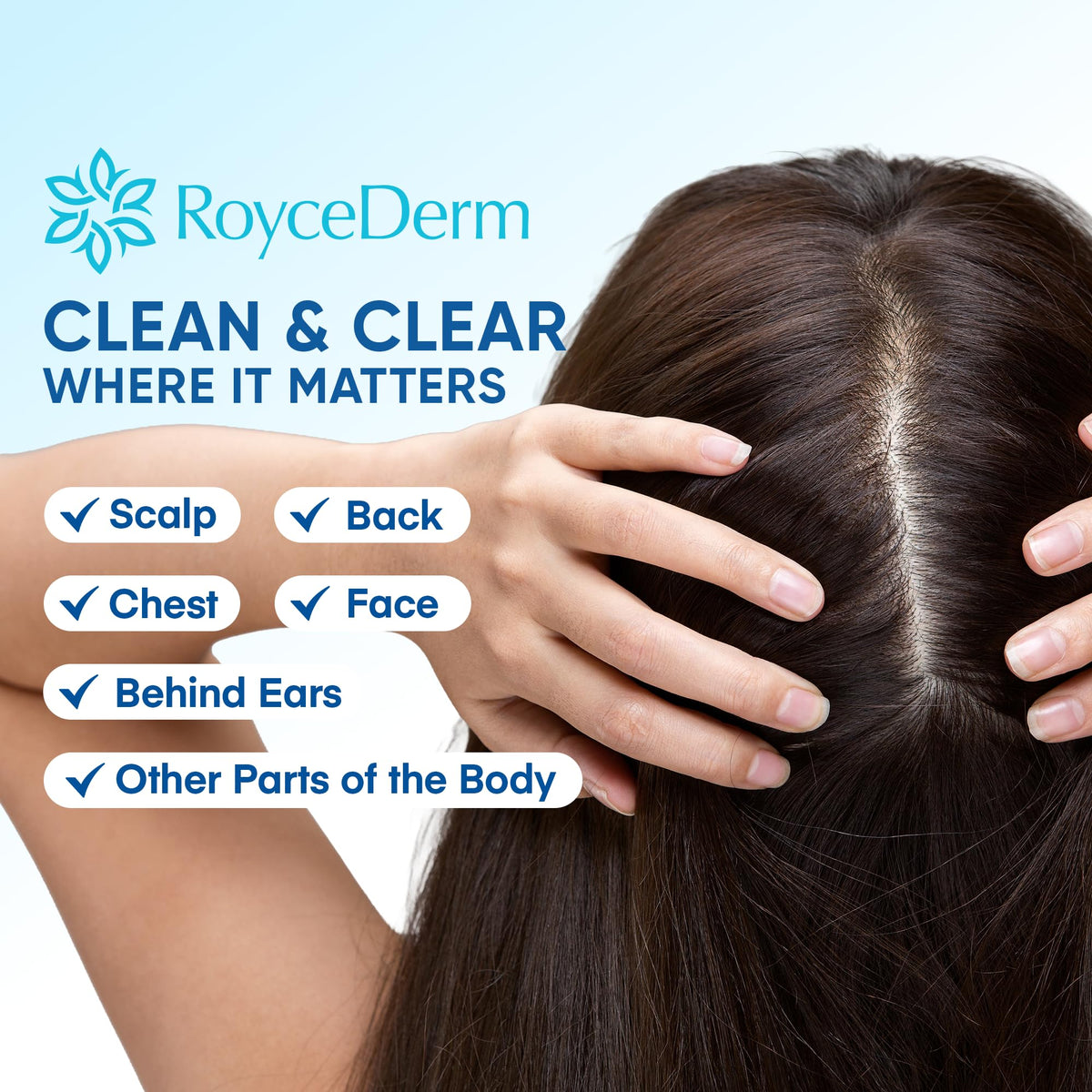 Roycederm Seborrheic & Psoriasis Calming Serum application on skin
