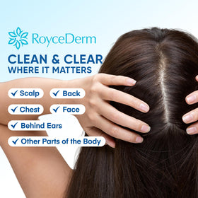 Roycederm Seborrheic & Psoriasis Calming Serum application on skin