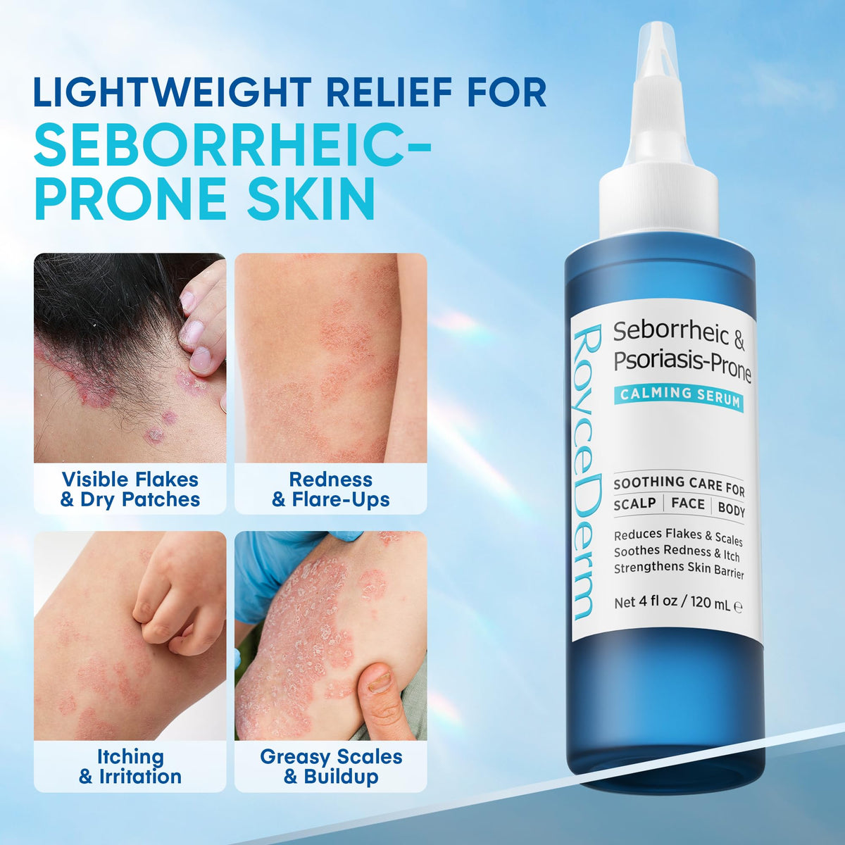 Roycederm Seborrheic & Psoriasis Calming Serum back view