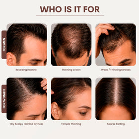 SØREN applicator in use on a scalp