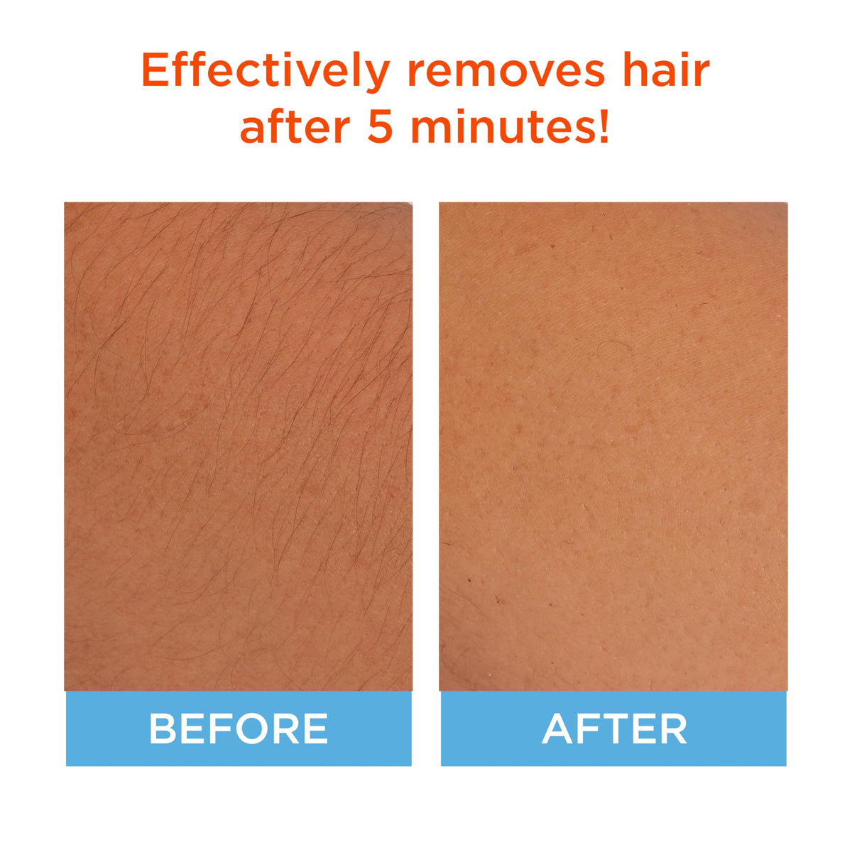 Sally Hansen Hair Remover for Face applicator close-up