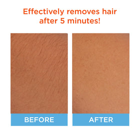 Sally Hansen Hair Remover for Face applicator close-up