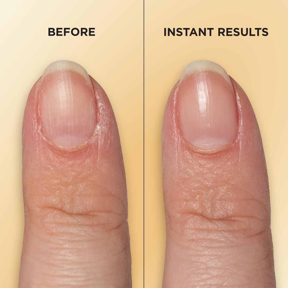 Sally Hansen Vitamin E Nail & Cuticle Pen packaging