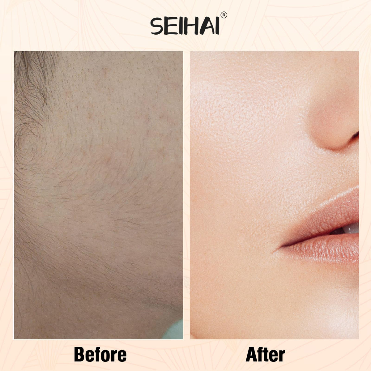 SEIHAI Facial Hair Remover in gray velvet storage bag