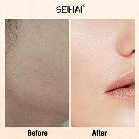 SEIHAI Facial Hair Remover in gray velvet storage bag