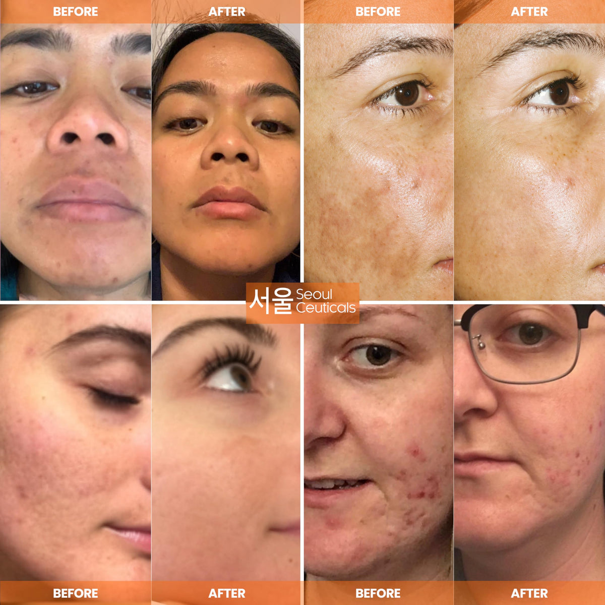 SeoulCeuticals Vitamin C Serum on a skincare shelf