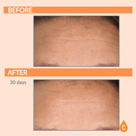 Serious Skincare Vitamin C Serum 1 Oz lifestyle application