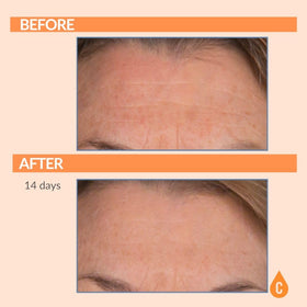 Serious Skincare Vitamin C Serum 1 Oz pump dispenser