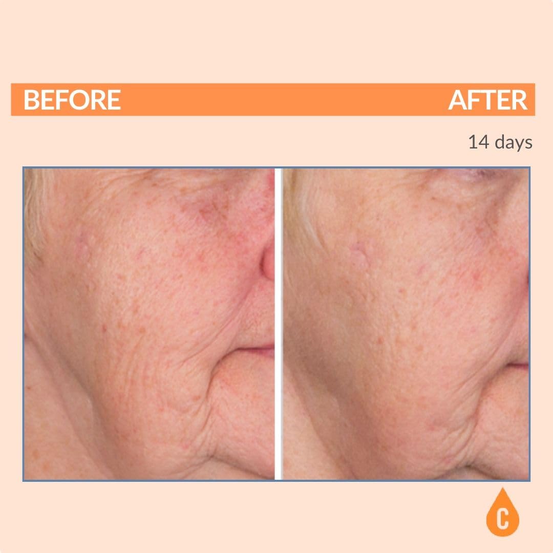 Serious Skincare Vitamin C Serum 1 Oz side view