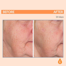 Serious Skincare Vitamin C Serum 1 Oz side view