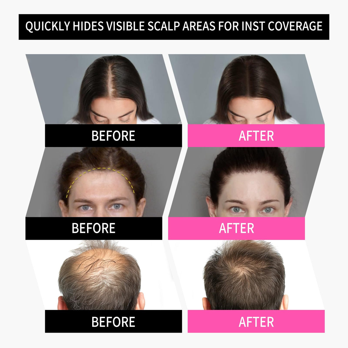 SEVICH Hairline Powder 2.0 Dark Brown with other hair care products