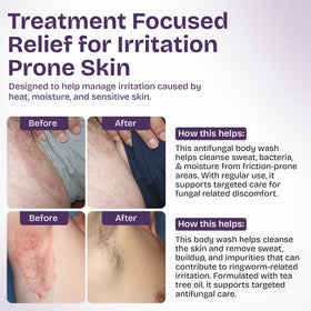 Shailee Antifungal Body Wash in a bathroom setting