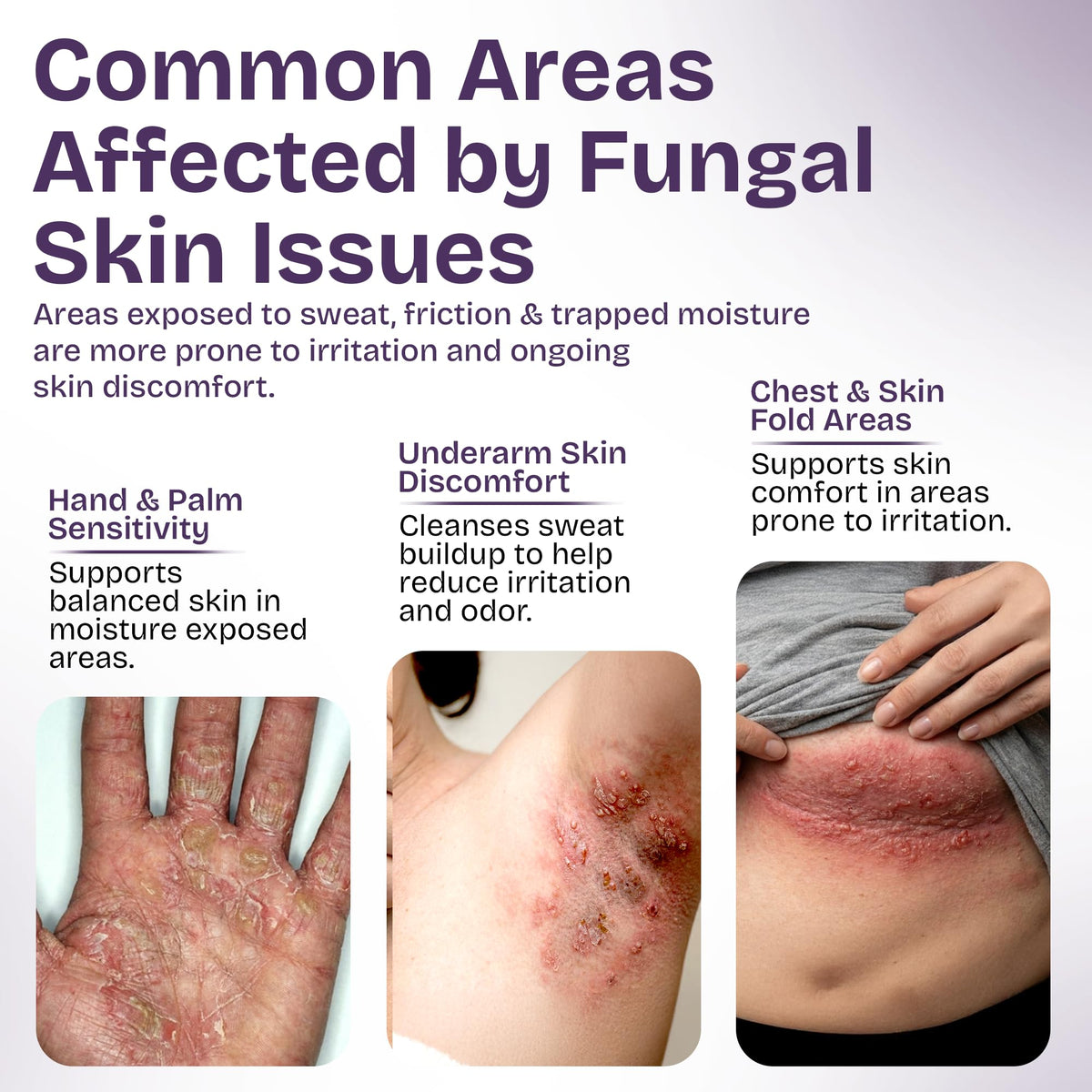 Shailee Antifungal Body Wash label close-up