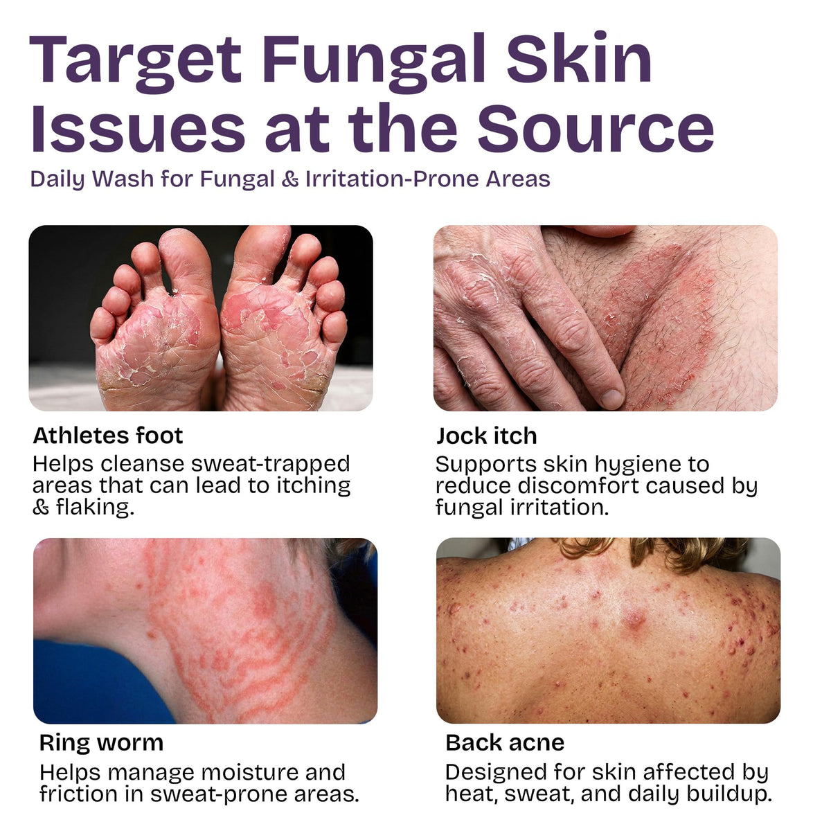 Shailee Antifungal Body Wash side view with pump