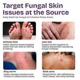 Shailee Antifungal Body Wash side view with pump